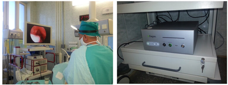 Полипы в носу