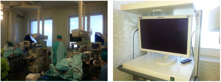 Полипозный риносинусит