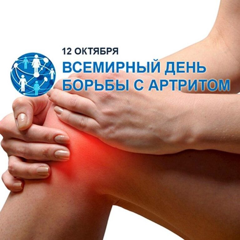 Всемирный день борьбы с артритом – 12 октября